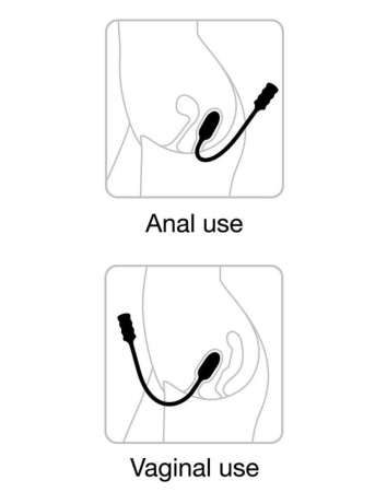 Виброяйцо Dorcel Deep Explorer, подходит для вагинальной и анальной стимуляции, мощное || Виброяйце Dorcel Deep Explorer, підходить для вагінальної та анальної стимуляції, потужне